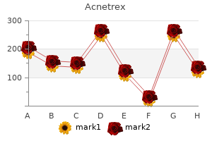 cheap acnetrex uk