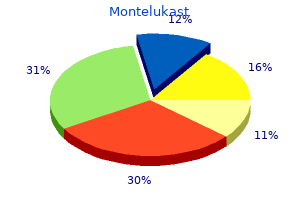montelukast 10 mg without a prescription