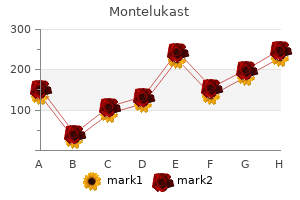 cheap montelukast 5mg