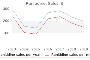 buy ranitidine 150 mg amex