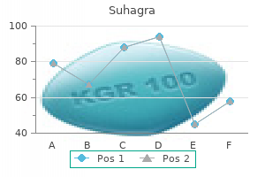 buy 50mg suhagra overnight delivery