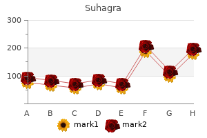 order generic suhagra from india