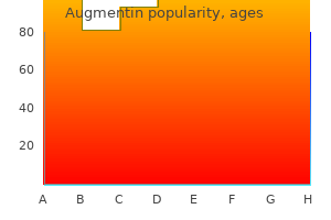 buy cheap augmentin 625mg online