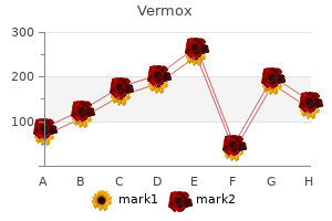 order generic vermox online