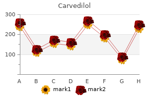 order carvedilol 25 mg online