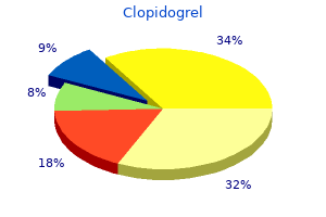 clopidogrel 75mg line