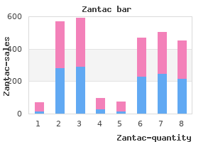 buy 300 mg zantac with amex