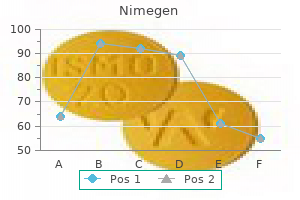 order nimegen on line amex